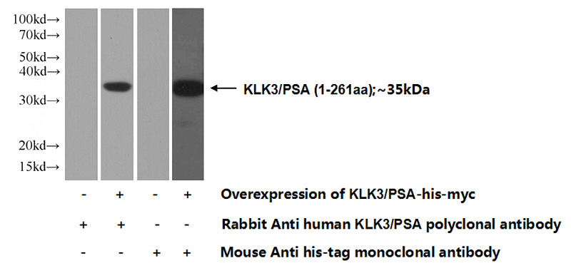 Transfected HEK-293 cells were subjected to SDS PAGE followed by western blot with Catalog No:112109(KLK3,PSA Antibody) at dilution of 1:1000