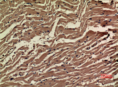 Immunohistochemical analysis of paraffin-embedded human-heart, antibody was diluted at 1:100