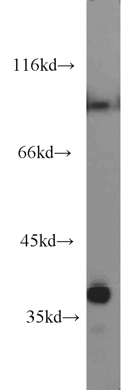 mouse kidney tissue were subjected to SDS PAGE followed by western blot with Catalog No:114078(PPA2 antibody) at dilution of 1:1000