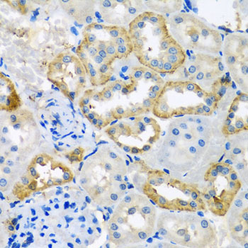 Immunohistochemistry - UQCR10 Polyclonal Antibody 