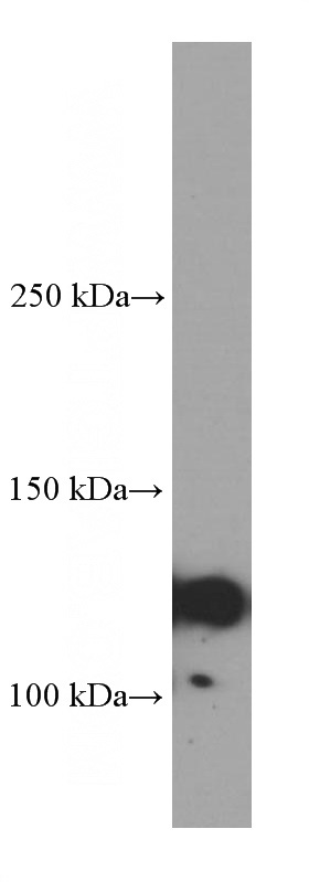 RAW 264.7 cells were subjected to SDS PAGE followed by western blot with Catalog No:107281(IGSF2 Antibody) at dilution of 1:1000