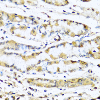 Immunohistochemistry - GNRH1 Polyclonal Antibody 