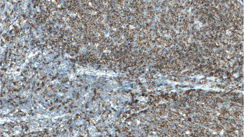 Immunohistochemistry of paraffin-embedded human tonsillitis tissue slide using Catalog No:107053(CD22 Antibody) at dilution of 1:400 (under 10x lens). heat mediated antigen retrieved with Tris-EDTA buffer(pH9).