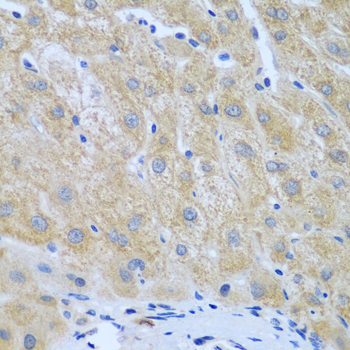 Immunohistochemistry - FURIN Polyclonal Antibody 