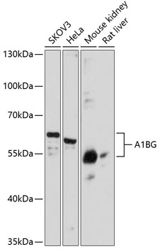 Western blot - A1BG Polyclonal Antibody 