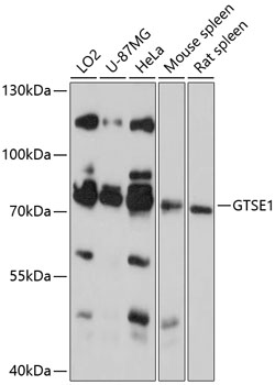 Western blot - GTSE1 Polyclonal Antibody 