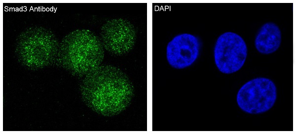 Immunofluorescent analysis of Hela cells, using Smad3 Antibody.