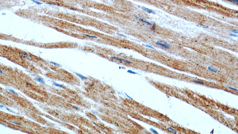 Immunohistochemistry of paraffin-embedded human heart slide using Catalog No:107319(MYL2 Antibody) at dilution of 1:50