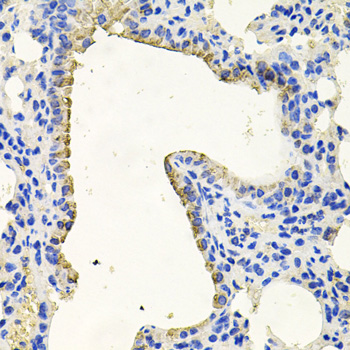 Immunohistochemistry - PKN1 Polyclonal Antibody 