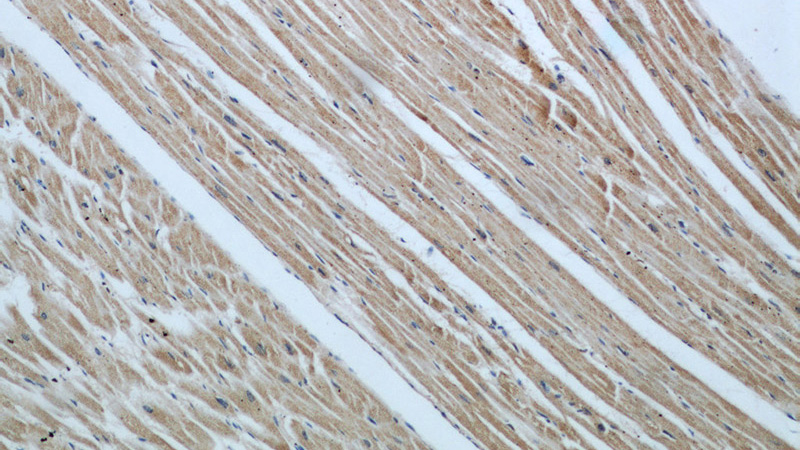 Immunohistochemical of paraffin-embedded human heart using Catalog No:109459(COPG2 antibody) at dilution of 1:50 (under 10x lens)