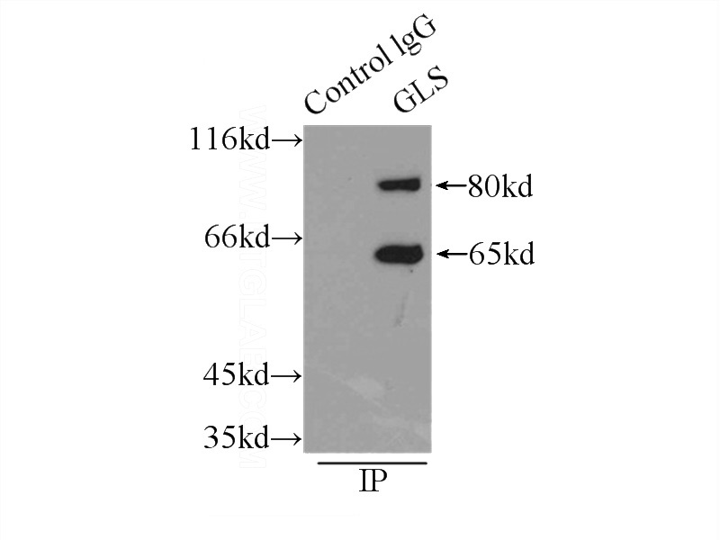 IP Result of anti-GLS (IP:Catalog No:112033, 4ug; Detection:Catalog No:112033 1:500) with mouse brain tissue lysate 8000ug.
