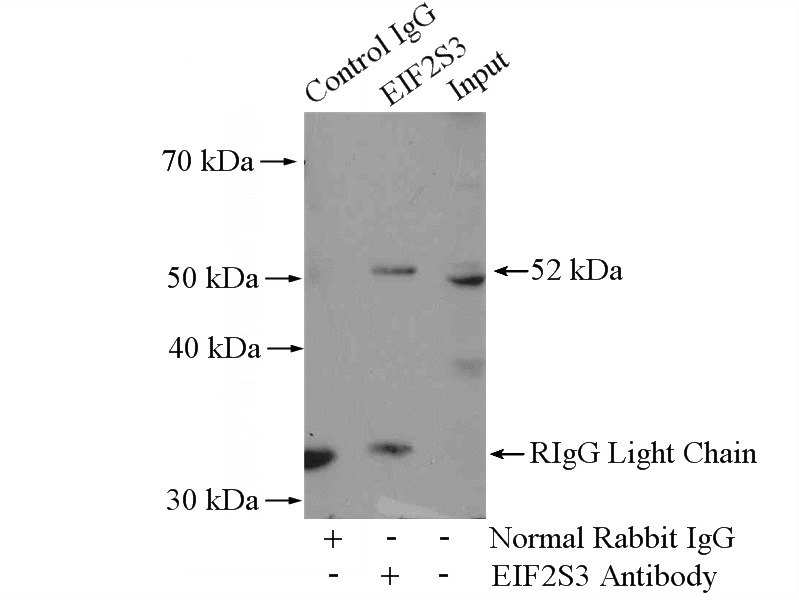 IP Result of anti-EIF2S3 (IP:Catalog No:110189, 4ug; Detection:Catalog No:110189 1:500) with HeLa cells lysate 2800ug.
