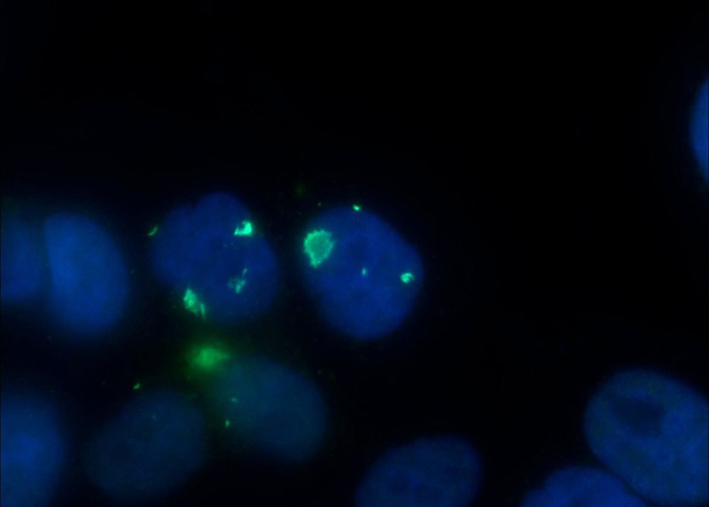 Immunofluorescent analysis of HepG2 cells using Catalog No:114382(PSMB2 Antibody) at dilution of 1:50 and Alexa Fluor 488-congugated AffiniPure Goat Anti-Rabbit IgG(H+L)
