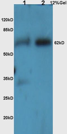 Fig2: Sample:; Brain(Mouse) Lysate at 30 ug; Brain(Rat) Lysate at 30 ug; Primary: Anti-TGF-beta-R2/TGFBR2 at 1/300 dilution; Secondary:IRDye800CW Goat Anti-Rabbit IgG at 1/20000 dilution; Predicted band size: 62 kD; Observed band size: 62 kD