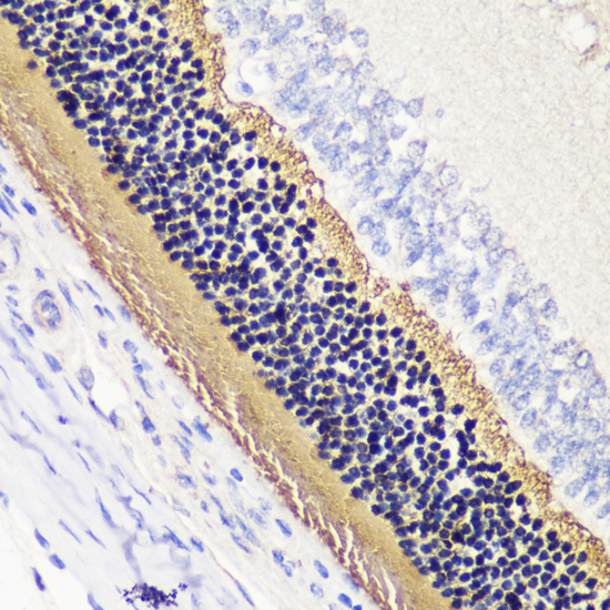 Immunohistochemistry - PDC Polyclonal Antibody 