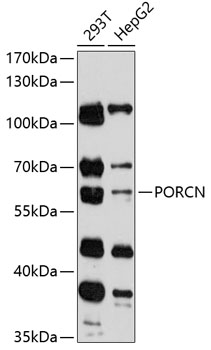 Western blot - PORCN Polyclonal Antibody 