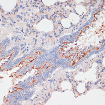 Immunohistochemistry - ZNRF3 Polyclonal Antibody 