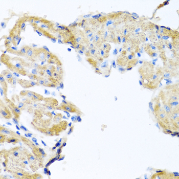 Immunohistochemistry - GPLD1 Polyclonal Antibody 
