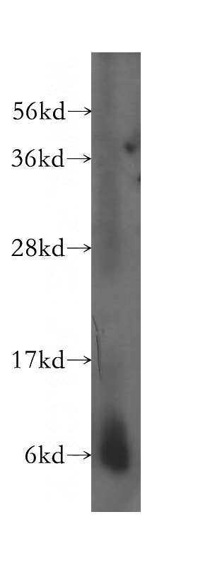 human liver tissue were subjected to SDS PAGE followed by western blot with Catalog No:115604(SS18L2 antibody) at dilution of 1:500