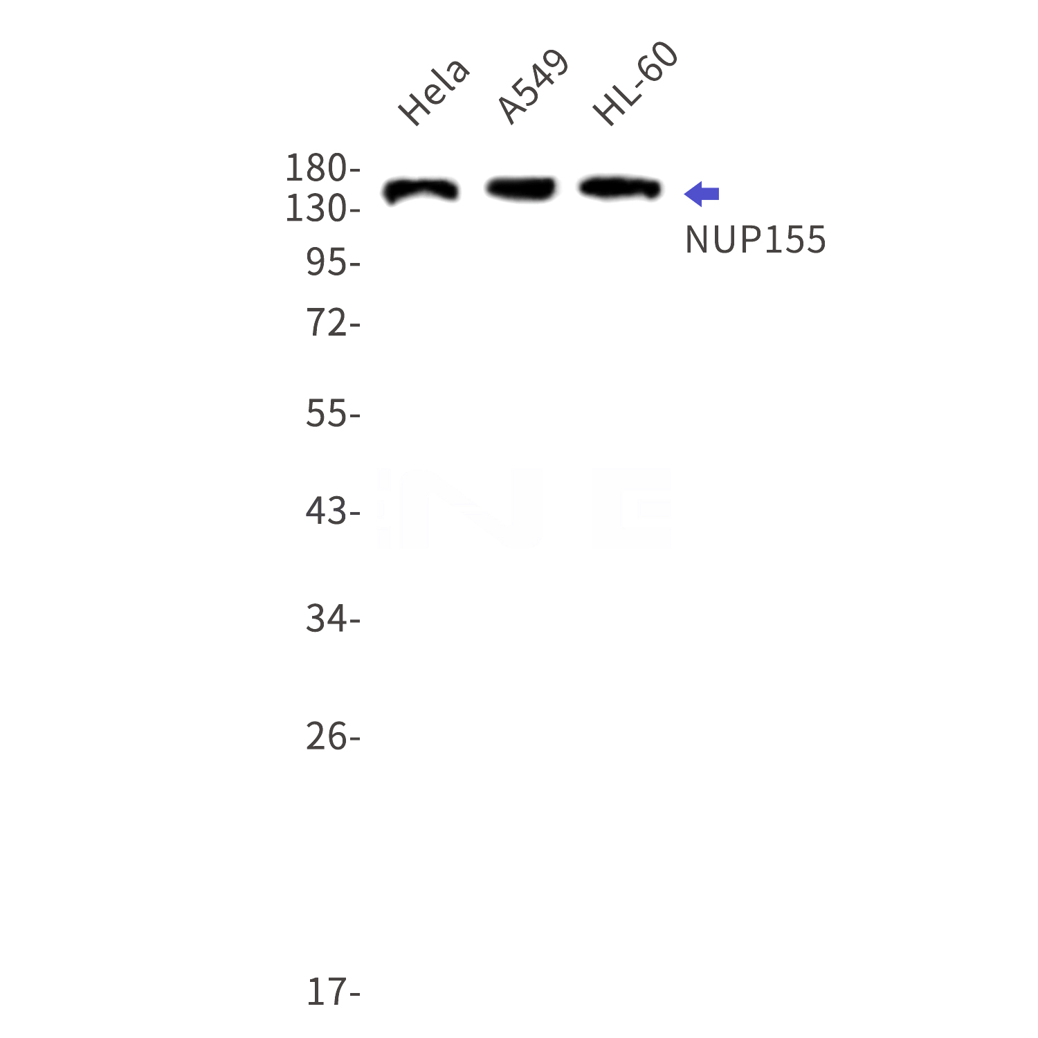 Western blot detection of NUP155 in Hela,A549,HL-60 cell lysates using NUP155 Rabbit mAb(1:1000 diluted).Predicted band size:155kDa.Observed band size:155kDa.