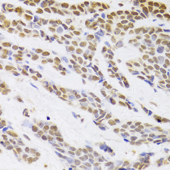 Immunohistochemistry - HDGF Polyclonal Antibody 