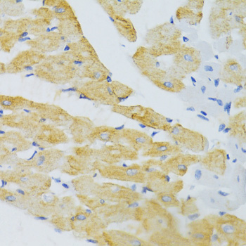 Immunohistochemistry - EDA Polyclonal Antibody 