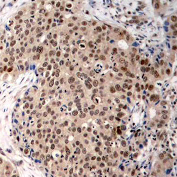 Immunohistochemistry - Phospho-MAPKAPK2-T334 pAb 
