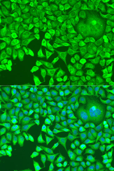 Immunofluorescence - pum1 Polyclonal Antibody 