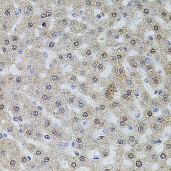 Immunohistochemistry - POP4 Polyclonal Antibody 