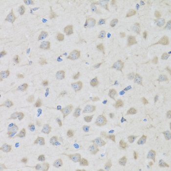 Immunohistochemistry - PENK Polyclonal Antibody 