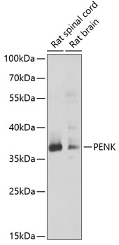 Western blot - PENK Polyclonal Antibody 