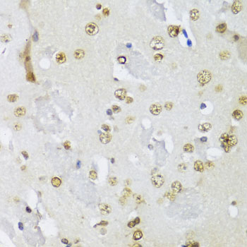Immunohistochemistry - IKBKE Polyclonal Antibody 