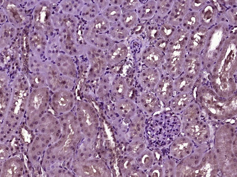 Fig1: Paraformaldehyde-fixed, paraffin embedded (Rat kidney); Antigen retrieval by boiling in sodium citrate buffer (pH6.0) for 15min; Block endogenous peroxidase by 3% hydrogen peroxide for 20 minutes; Blocking buffer (normal goat serum) at 37℃ for 30min; Antibody incubation with (HIF3 alpha) Polyclonal Antibody, Unconjugated at 1:400 overnight at 4℃, followed by operating according to SP Kit(Rabbit) (sp-0023) instructionsand DAB staining.