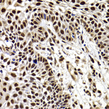 Immunohistochemistry - HIRIP3 Polyclonal Antibody 