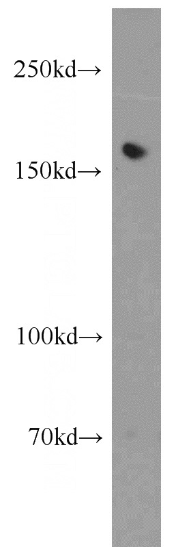 K-562 cells were subjected to SDS PAGE followed by western blot with Catalog No:116122(TIE1 antibody) at dilution of 1:300