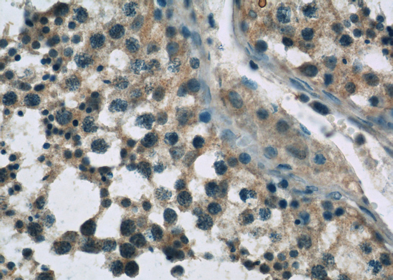 Immunohistochemistry of paraffin-embedded human testis slide using Catalog No:116627(UPF3B Antibody) at dilution of 1:50