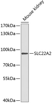 Western blot - SLC22A2 Polyclonal Antibody 