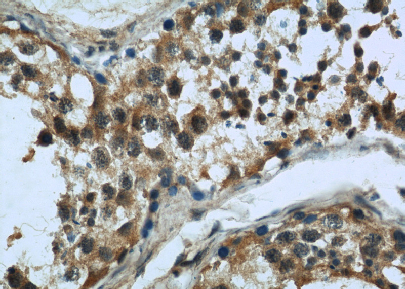 Immunohistochemistry of paraffin-embedded human testis slide using Catalog No:107410(MAD2L1 Antibody) at dilution of 1:50