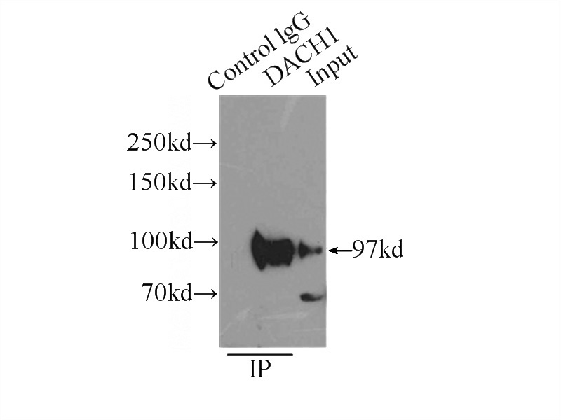 IP Result of anti-DACH1 (IP:Catalog No:109853, 4ug; Detection:Catalog No:109853 1:1000) with HEK-293 cells lysate 6000ug.