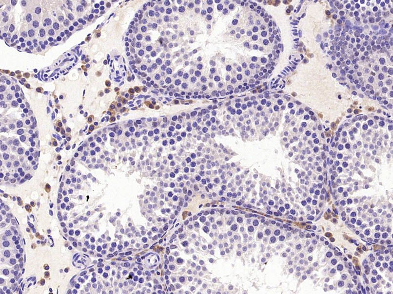 Fig2: Paraformaldehyde-fixed, paraffin embedded (Rat testis); Antigen retrieval by microwave in sodium citrate buffer (pH6.0) ; Block endogenous peroxidase by 3% hydrogen peroxide for 30 minutes; Blocking buffer (3% BSA) at RT for 30min; Antibody incubation with (HSPBAP1) Polyclonal Antibody, Unconjugated at 1:400 overnight at 4℃, followed by conjugation to the secondary antibody (labeled with HRP)and DAB staining.