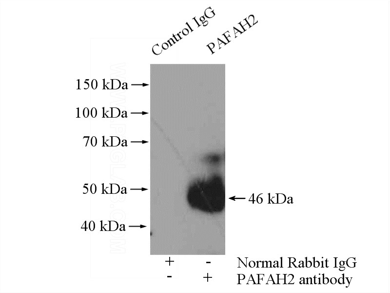 IP Result of anti-PAFAH2 (IP:Catalog No:113488, 4ug; Detection:Catalog No:113488 1:300) with mouse liver tissue lysate 6400ug.