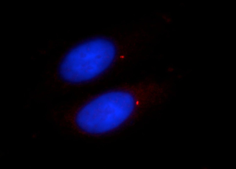 Immunofluorescent analysis of HepG2 cells using Catalog No:109254(CENPJ Antibody) at dilution of 1:25 and Rhodamine-Goat anti-Rabbit IgG
