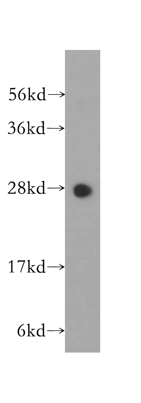 human lung tissue were subjected to SDS PAGE followed by western blot with Catalog No:114374(PSMA3 antibody) at dilution of 1:400