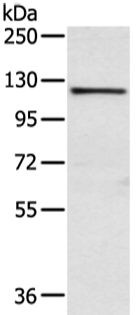 Gel: 6%SDS-PAGE, Lysate: 40 μg, Lane: PC3 cell, Primary antibody: 169081(WWP1 Antibody) at dilution 1/750, Secondary antibody: Goat anti rabbit IgG at 1/8000 dilution, Exposure time: 10 seconds