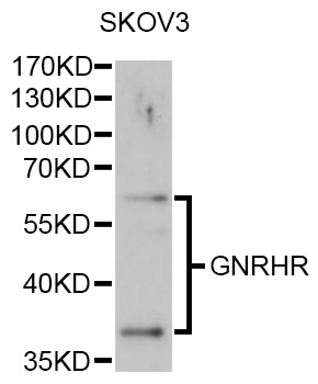 Western blot - GNRHR Polyclonal Antibody 