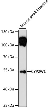 Western blot - CYP2W1 Polyclonal Antibody 