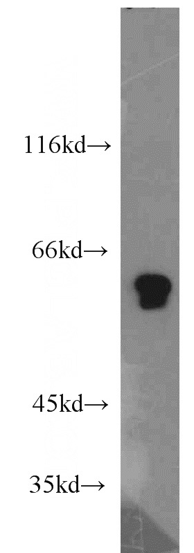 mouse skeletal muscle tissue were subjected to SDS PAGE followed by western blot with Catalog No:114108(PPP3CA antibody) at dilution of 1:1500