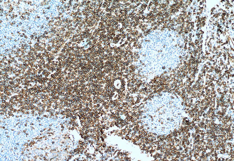 Immunohistochemistry of paraffin-embedded human tonsillitis tissue slide using (SPN Antibody) at dilution of 1:100 (under 10x lens). . Heat mediated antigen retrieved with Tris-EDTA buffer, pH9.0