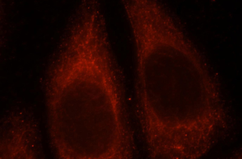 Immunofluorescent analysis of HepG2 cells, using UGT2B7 antibody Catalog No:116559 at 1:25 dilution and Rhodamine-labeled goat anti-rabbit IgG (red).