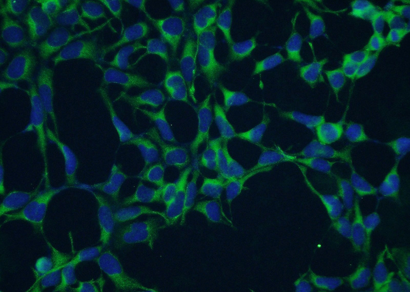Immunofluorescent analysis of HEK-293 cells using Catalog No:110964(GHDC Antibody) at dilution of 1:50 and Alexa Fluor 488-congugated AffiniPure Goat Anti-Rabbit IgG(H+L)